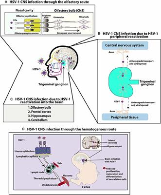 Herpes Simplex Virus Type 1 Infection of the Central Nervous System: Insights Into Proposed Interrelationships With Neurodegenerative Disorders